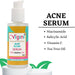 Vigini 15% Actives Anti Acne Face Serum 30 ml health & wellness Global Medicare Inc 